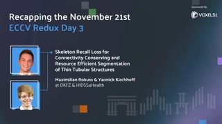 ECCV 2024 - Skeleton Recall Loss for Connectivity Conserving and Resource Efficient Segmentation of Thin Tubular Structures